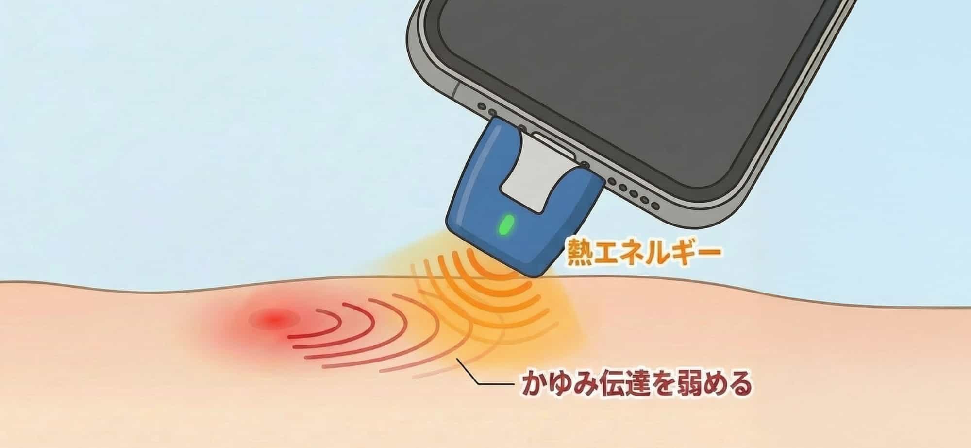 熱エネルギーがかゆみの伝達を抑える